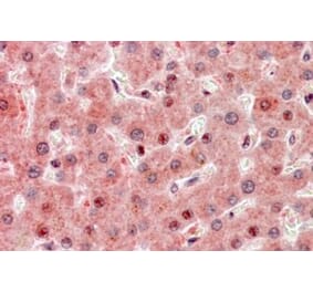 Immunohistochemistry - Anti-RASSF1A Antibody (A326284) - Antibodies.com