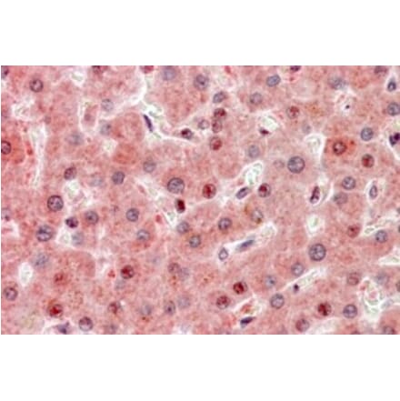 Immunohistochemistry - Anti-RASSF1A Antibody (A326284) - Antibodies.com