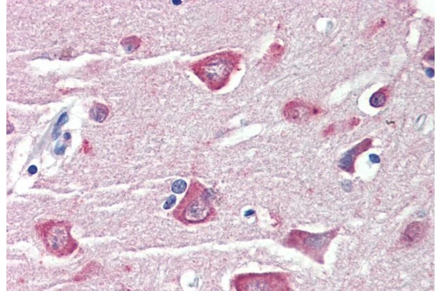 Immunohistochemistry - Anti-RASSF1A Antibody (A326284) - Antibodies.com