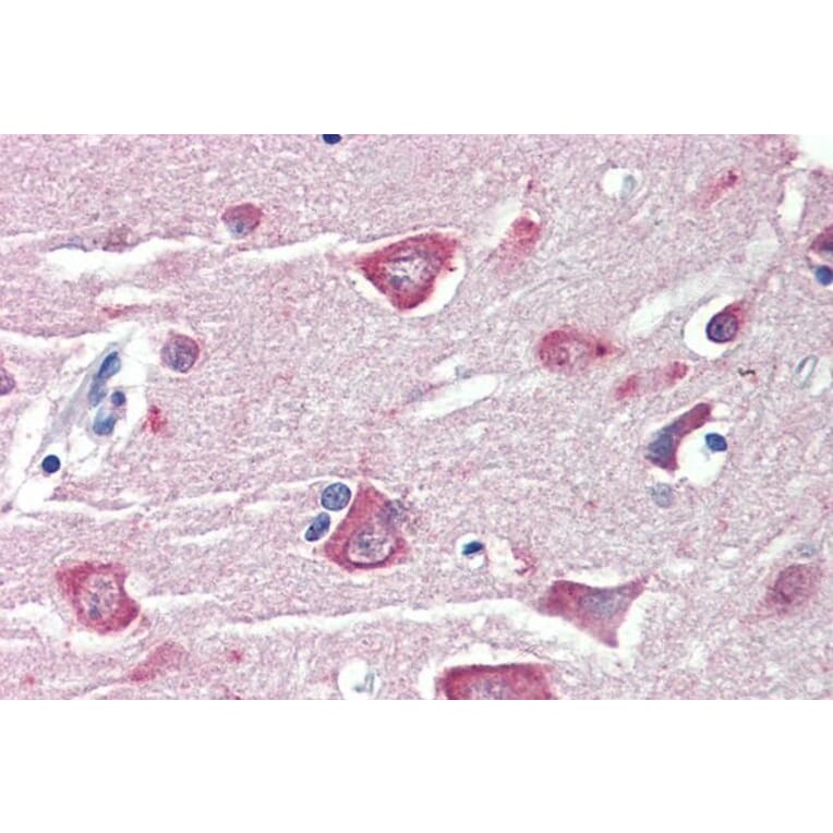 Immunohistochemistry - Anti-RASSF1A Antibody (A326284) - Antibodies.com