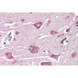 Immunohistochemistry - Anti-RASSF1A Antibody (A326284) - Antibodies.com