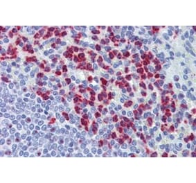 Immunohistochemistry - Anti-RASSF2 Antibody (A326285) - Antibodies.com