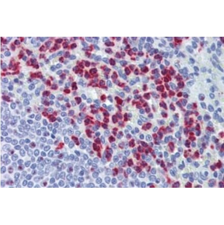 Immunohistochemistry - Anti-RASSF2 Antibody (A326285) - Antibodies.com