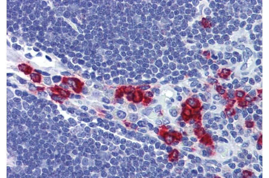 Immunohistochemistry - Anti-RASSF2 Antibody (A326285) - Antibodies.com