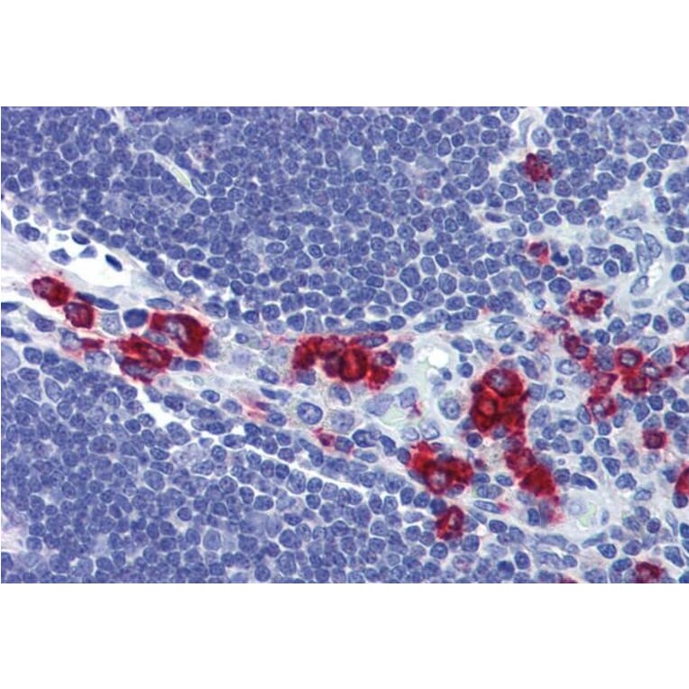 Immunohistochemistry - Anti-RASSF2 Antibody (A326285) - Antibodies.com