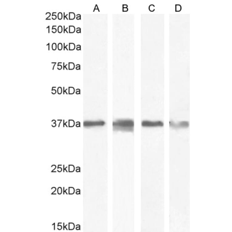Western Blot - Anti-RSPO3 Antibody (A326286) - Antibodies.com