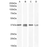 Western Blot - Anti-RSPO3 Antibody (A326286) - Antibodies.com