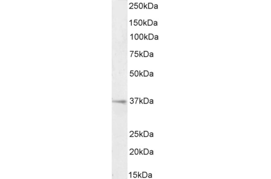 Western Blot - Anti-RSPO3 Antibody (A326286) - Antibodies.com