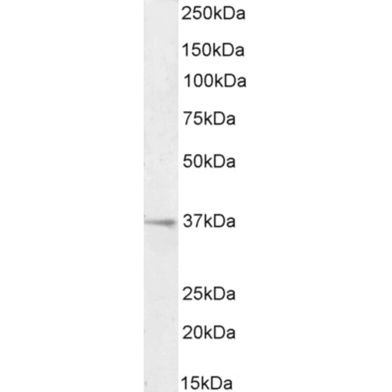 Western Blot - Anti-RSPO3 Antibody (A326286) - Antibodies.com