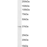 Western Blot - Anti-RSPO3 Antibody (A326286) - Antibodies.com