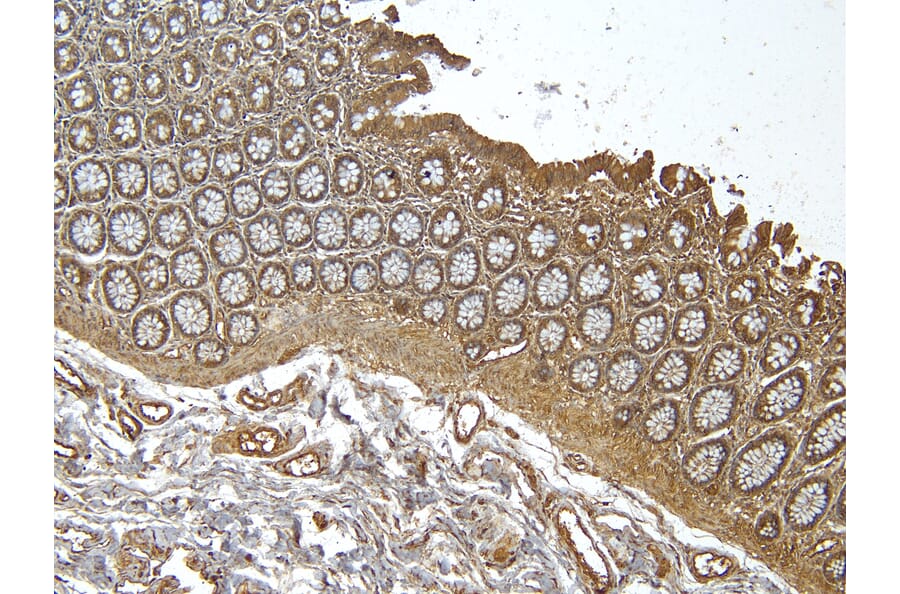 Immunohistochemistry - Anti-RSPO3 Antibody (A326286) - Antibodies.com