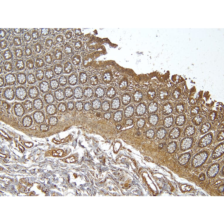 Immunohistochemistry - Anti-RSPO3 Antibody (A326286) - Antibodies.com