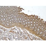 Immunohistochemistry - Anti-RSPO3 Antibody (A326286) - Antibodies.com