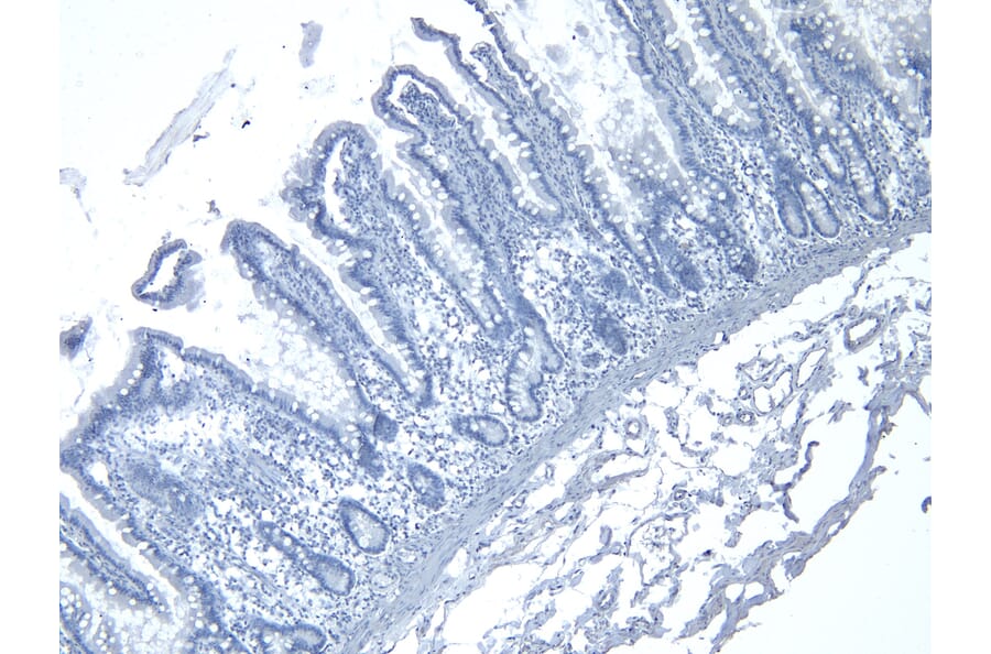 Immunohistochemistry - Anti-RSPO3 Antibody (A326286) - Antibodies.com