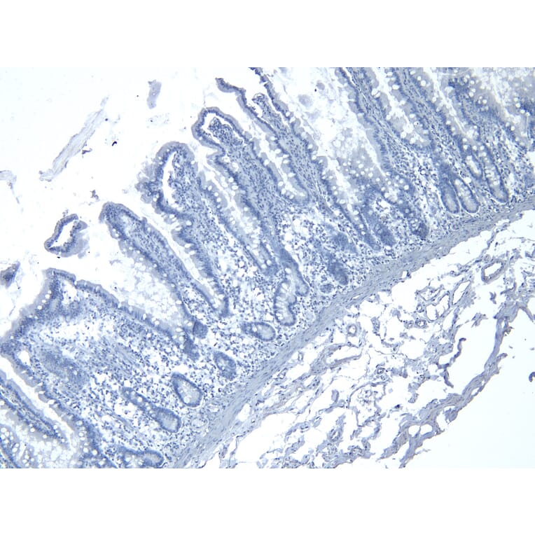 Immunohistochemistry - Anti-RSPO3 Antibody (A326286) - Antibodies.com