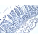 Immunohistochemistry - Anti-RSPO3 Antibody (A326286) - Antibodies.com