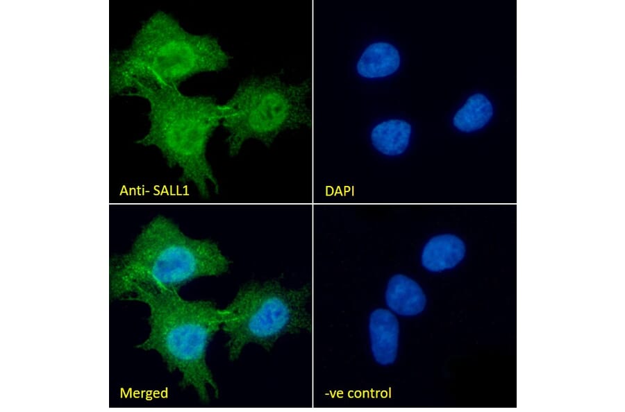 Immunofluorescence - Anti-SALL1 Antibody (A326287) - Antibodies.com