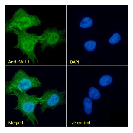 Immunofluorescence - Anti-SALL1 Antibody (A326287) - Antibodies.com