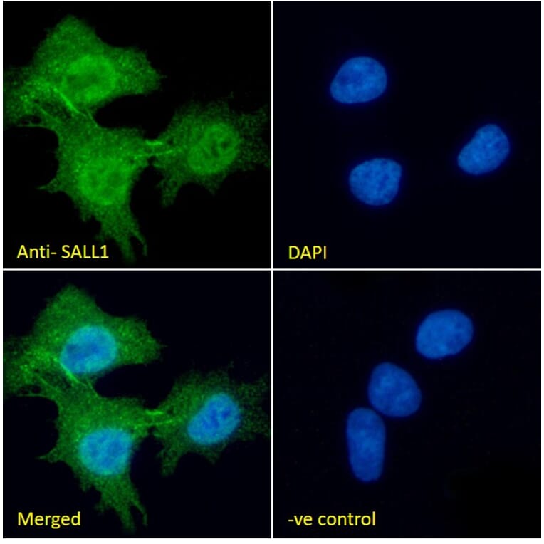 Immunofluorescence - Anti-SALL1 Antibody (A326287) - Antibodies.com