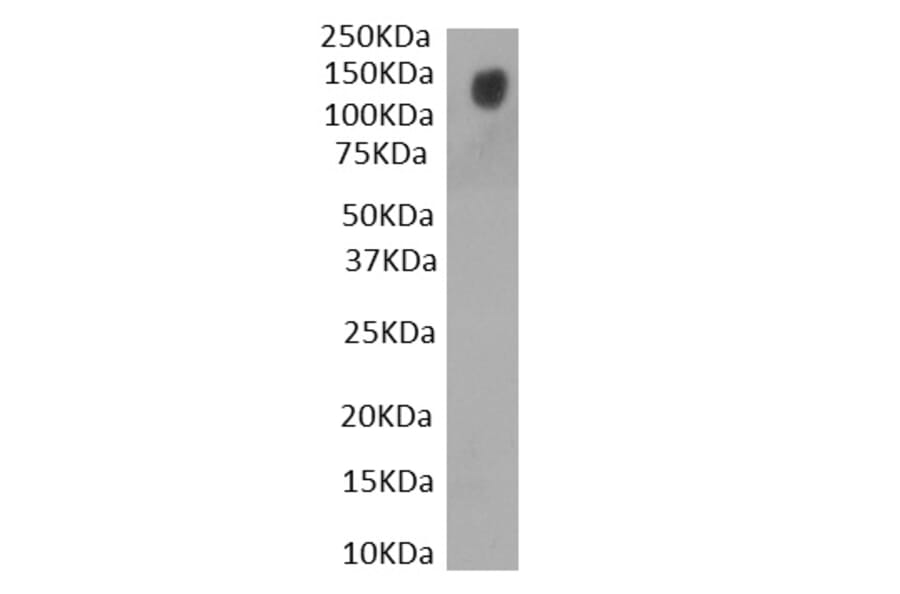 Western Blot - Anti-SARS-CoV-2 Spike Protein S1 Antibody (A326289) - Antibodies.com
