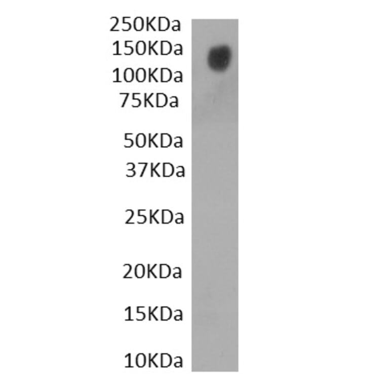 Western Blot - Anti-SARS-CoV-2 Spike Protein S1 Antibody (A326289) - Antibodies.com