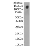 Western Blot - Anti-SARS-CoV-2 Spike Protein S1 Antibody (A326289) - Antibodies.com
