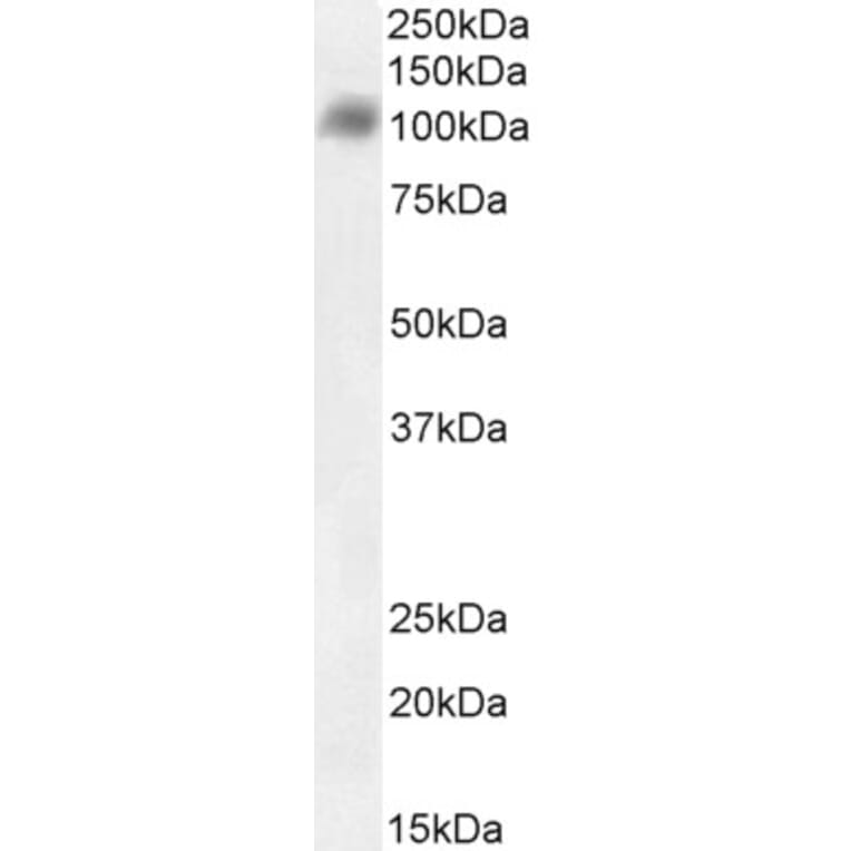 Western Blot - Anti-SARS-CoV-2 Spike Protein S1 Antibody (A326290) - Antibodies.com