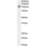 Western Blot - Anti-SARS-CoV-2 Spike Protein S1 Antibody (A326290) - Antibodies.com