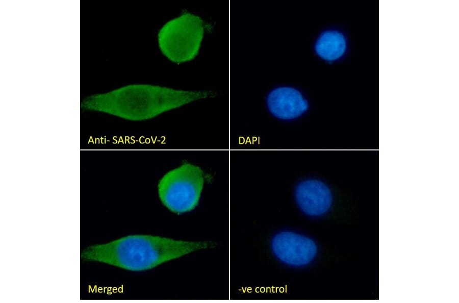 Immunofluorescence - Anti-SARS-CoV-2 Spike Protein S1 Antibody (A326290) - Antibodies.com