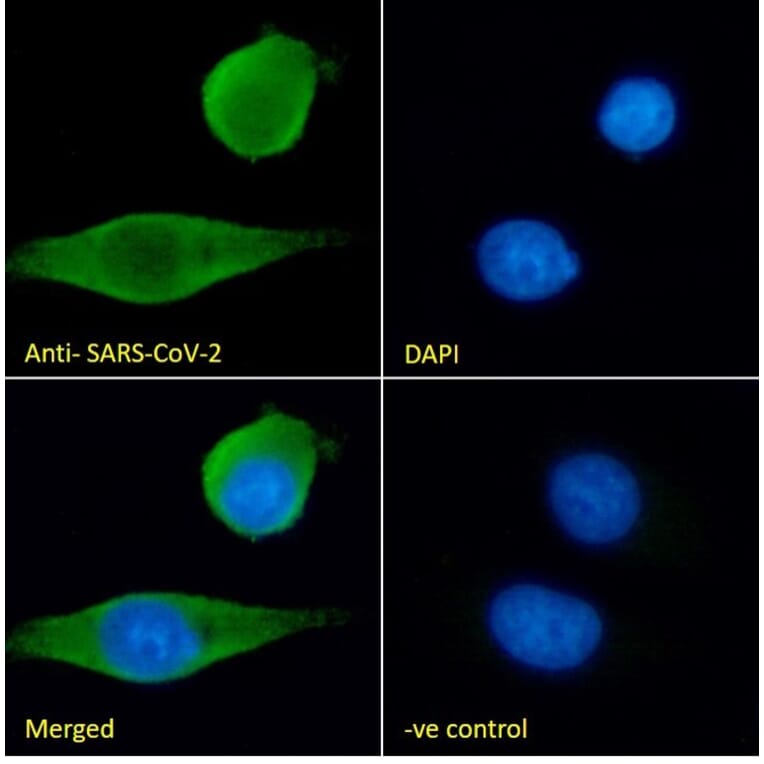 Immunofluorescence - Anti-SARS-CoV-2 Spike Protein S1 Antibody (A326290) - Antibodies.com