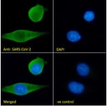 Immunofluorescence - Anti-SARS-CoV-2 Spike Protein S1 Antibody (A326290) - Antibodies.com