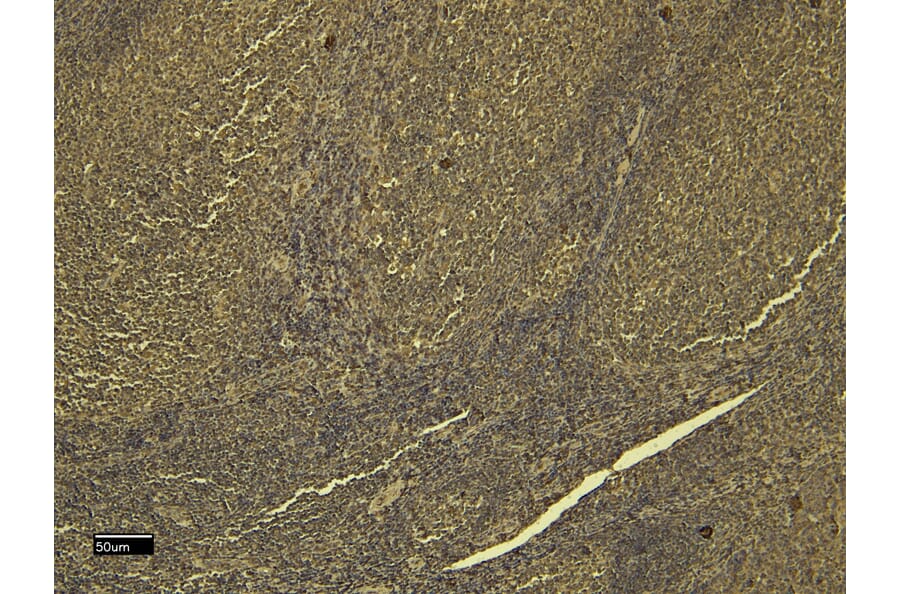 Immunohistochemistry - Anti-SCRIBBLE Antibody (A326291) - Antibodies.com
