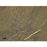 Immunohistochemistry - Anti-SCRIBBLE Antibody (A326291) - Antibodies.com
