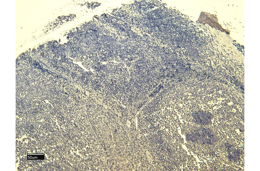 Immunohistochemistry - Anti-SCRIBBLE Antibody (A326291) - Antibodies.com