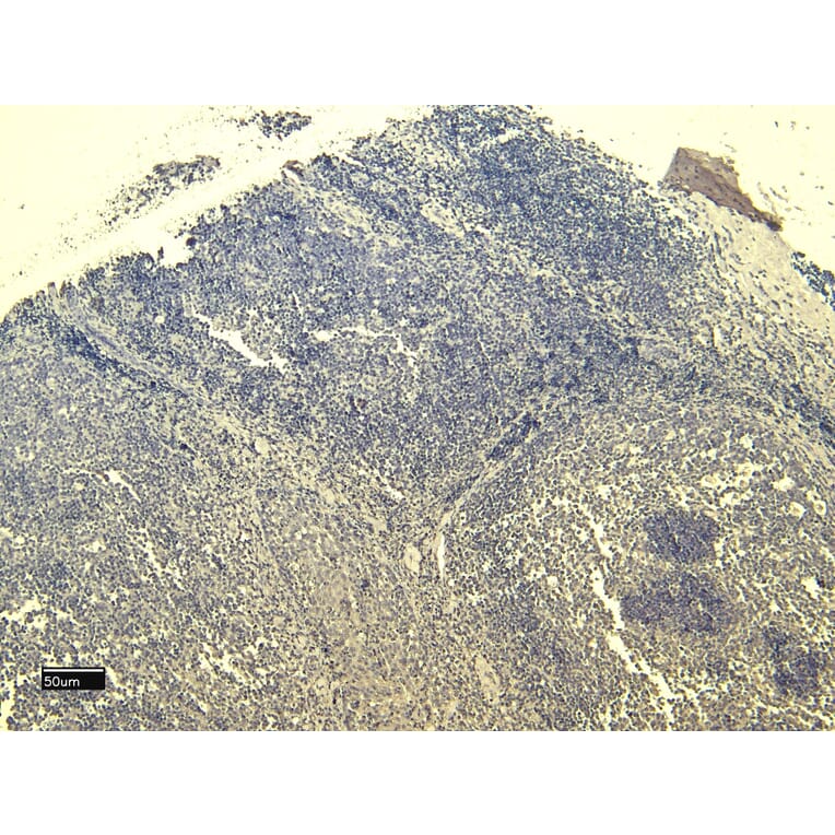 Immunohistochemistry - Anti-SCRIBBLE Antibody (A326291) - Antibodies.com