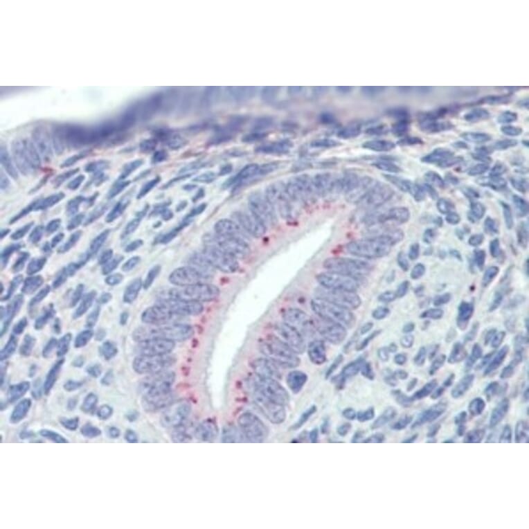 Immunohistochemistry - Anti-SFRP1 Antibody (A326293) - Antibodies.com
