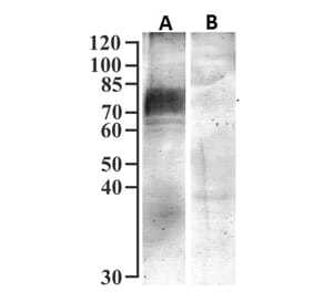 Western Blot - Anti-SGLT1 Antibody (A326294) - Antibodies.com