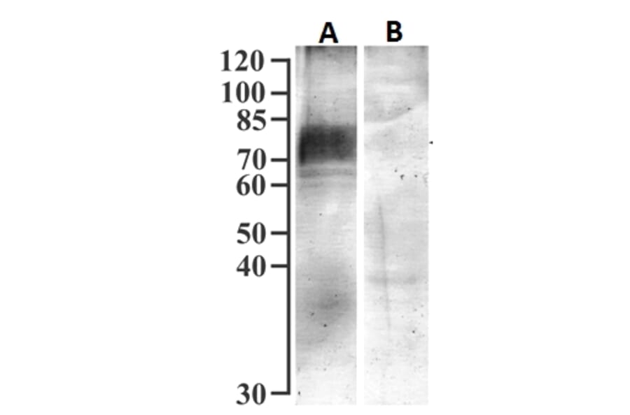 Western Blot - Anti-SGLT1 Antibody (A326294) - Antibodies.com