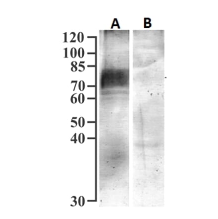 Western Blot - Anti-SGLT1 Antibody (A326294) - Antibodies.com