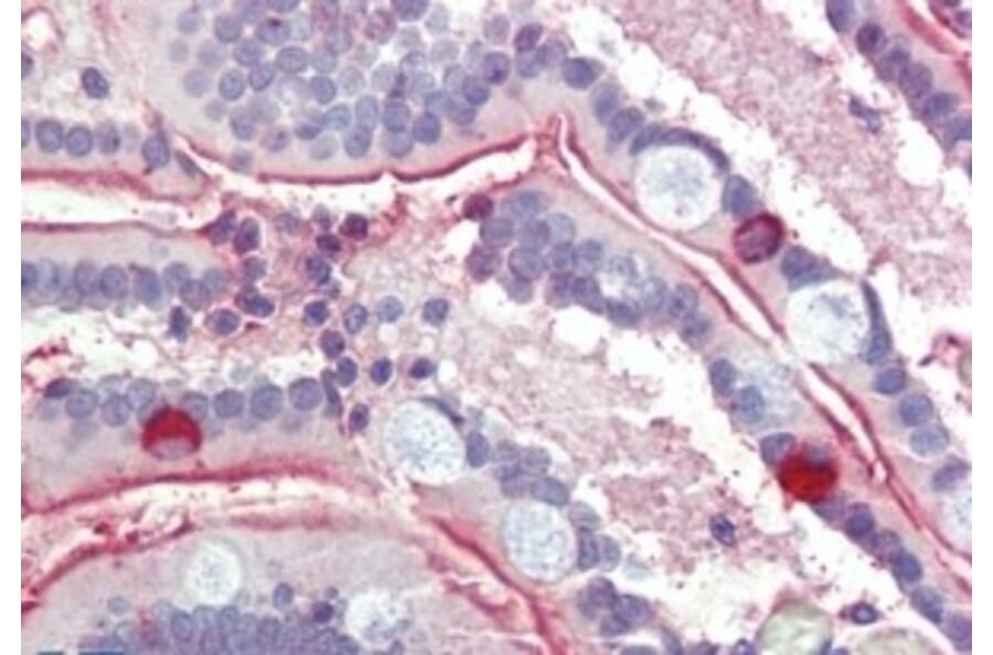 Immunohistochemistry - Anti-SGLT1 Antibody (A326294) - Antibodies.com