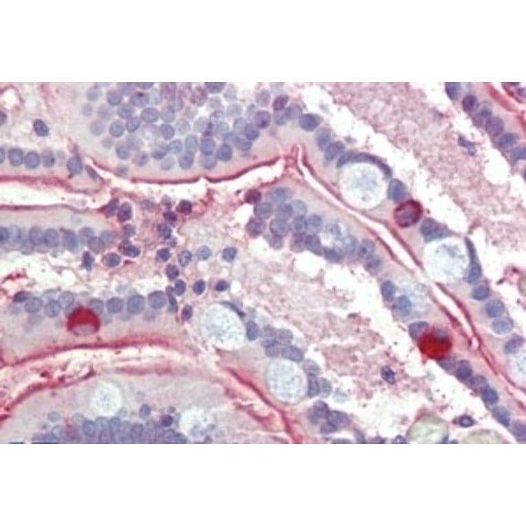 Immunohistochemistry - Anti-SGLT1 Antibody (A326294) - Antibodies.com