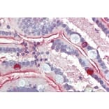 Immunohistochemistry - Anti-SGLT1 Antibody (A326294) - Antibodies.com