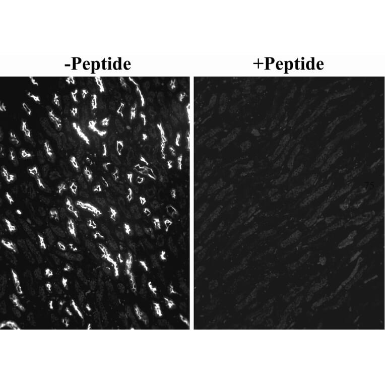 Immunocytochemistry - Anti-SGLT1 Antibody (A326294) - Antibodies.com
