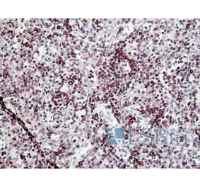 Immunohistochemistry - Anti-SH3KBP1 Antibody (A326295) - Antibodies.com