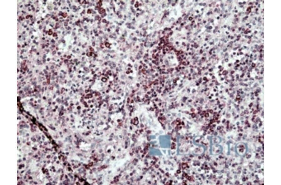 Immunohistochemistry - Anti-SH3KBP1 Antibody (A326295) - Antibodies.com