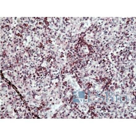 Immunohistochemistry - Anti-SH3KBP1 Antibody (A326295) - Antibodies.com
