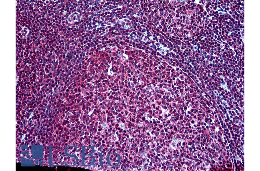 Immunohistochemistry - Anti-SH3KBP1 Antibody (A326295) - Antibodies.com