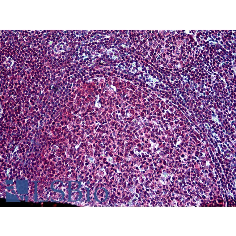 Immunohistochemistry - Anti-SH3KBP1 Antibody (A326295) - Antibodies.com