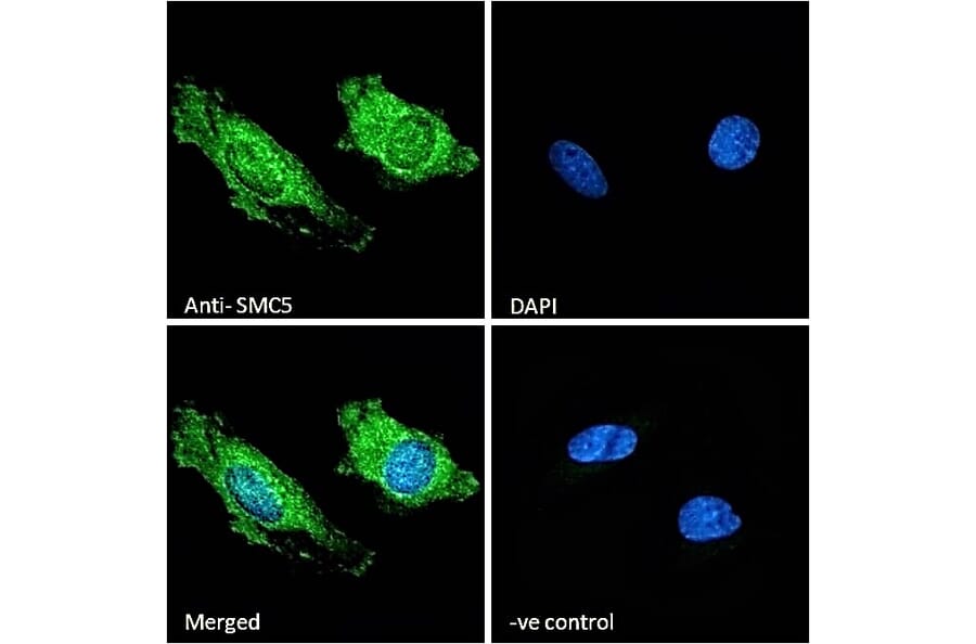 Immunofluorescence - Anti-SMC5 Antibody (A326299) - Antibodies.com