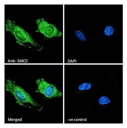 Immunofluorescence - Anti-SMC5 Antibody (A326299) - Antibodies.com